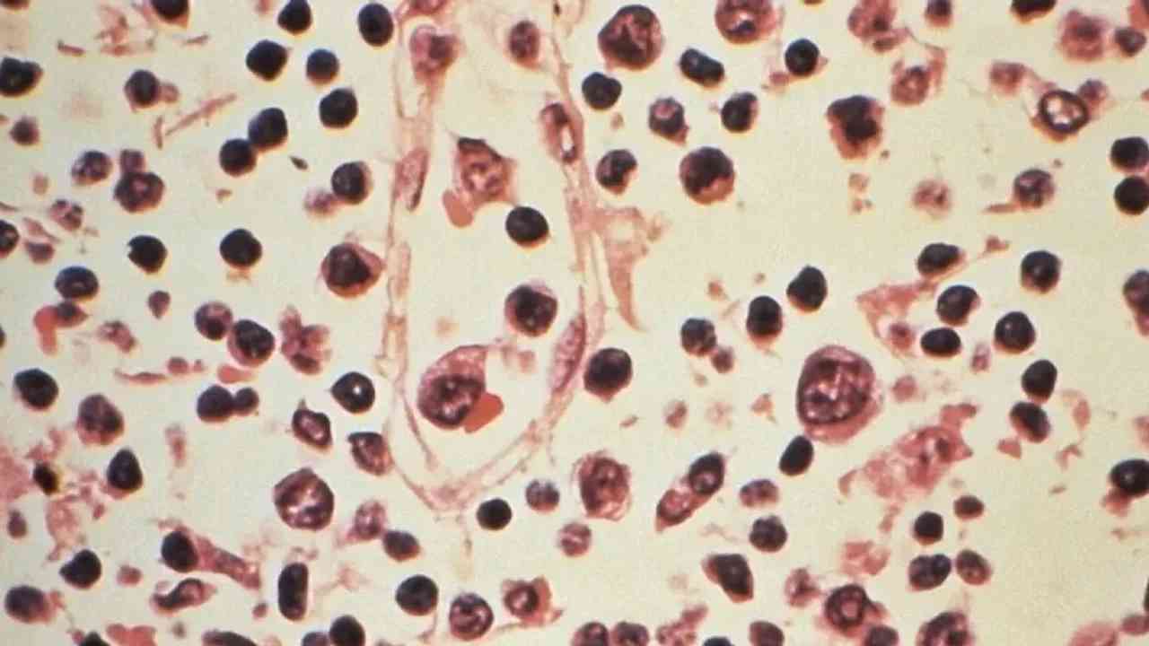 La Suisse enregistre un cas d'hantavirus