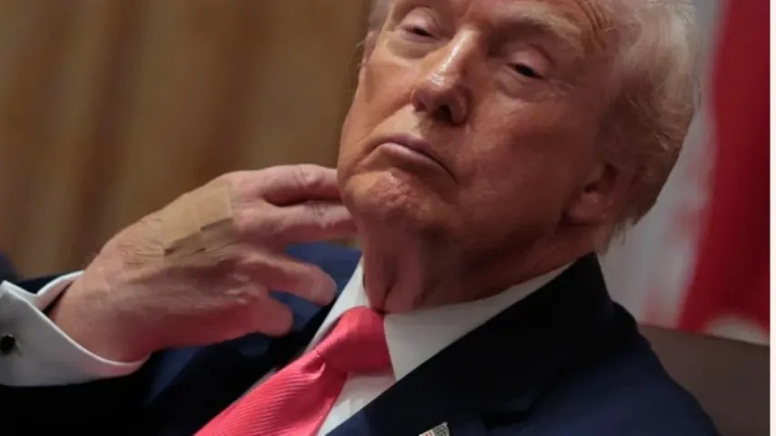 Trump avec des pansements adhésifs aux mains, Maison-Blanche : Il n'est pas malade